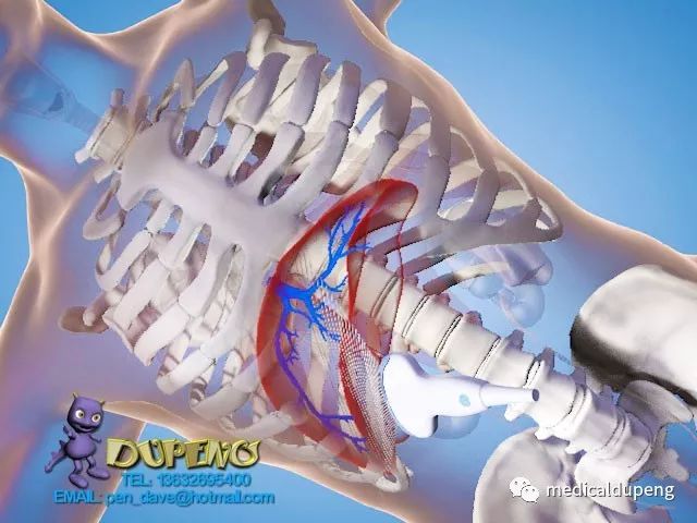 医学插画插图,医学插画sci