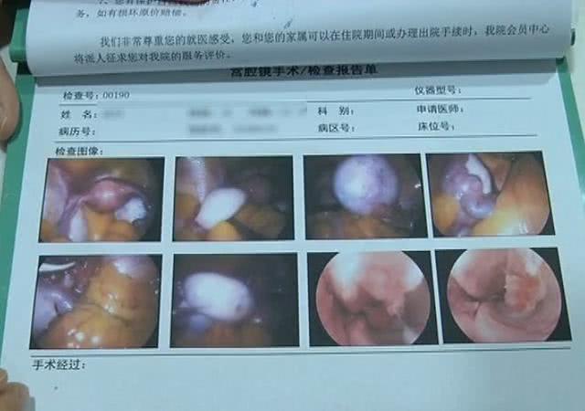 未婚女孩月经一直不干净怎么回事,21岁未婚女孩月经不调