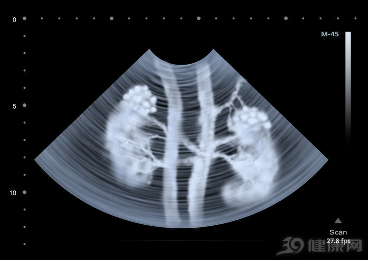 四肢浮肿脸也浮肿是什么原因,四肢发黄脸发黄