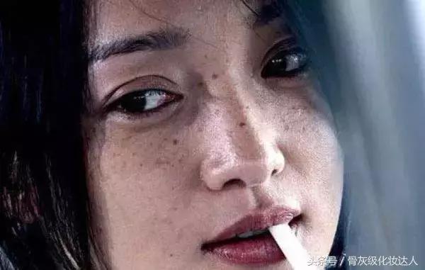 长了斑点怎么去除,长色斑怎么办5大方法祛除色斑