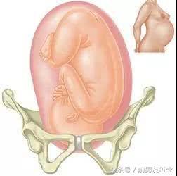 摸肚子能感觉胎儿入盆吗,这些分娩信号你都知道吗