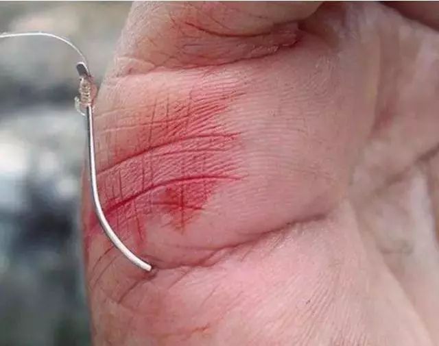 钓鱼遇到最痛苦的事情,钓鱼容易受伤吗