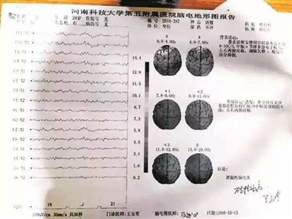 认为自己有精神病的算是精神病吗,怎样说自己不是精神病院的人