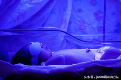 新生儿黄疸需要就医吗,新生儿黄疸照蓝光又反复咋办