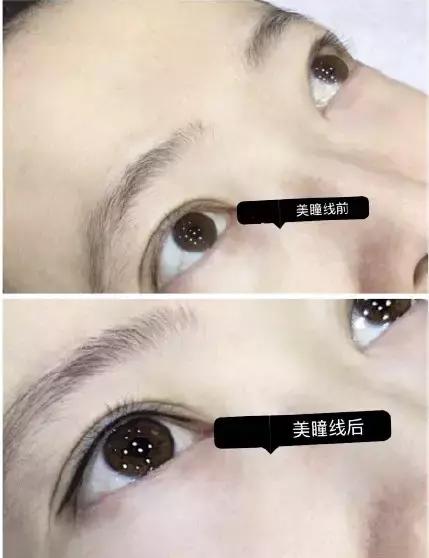 半永久眉毛为什么做不到一模一样,半永久眉毛即刻成效果