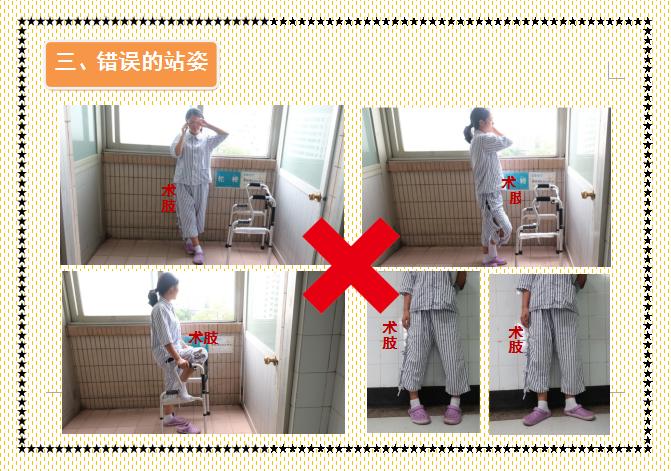 人工股骨头置换术术后教学查房,人工髋关节置换术后护理注意事项