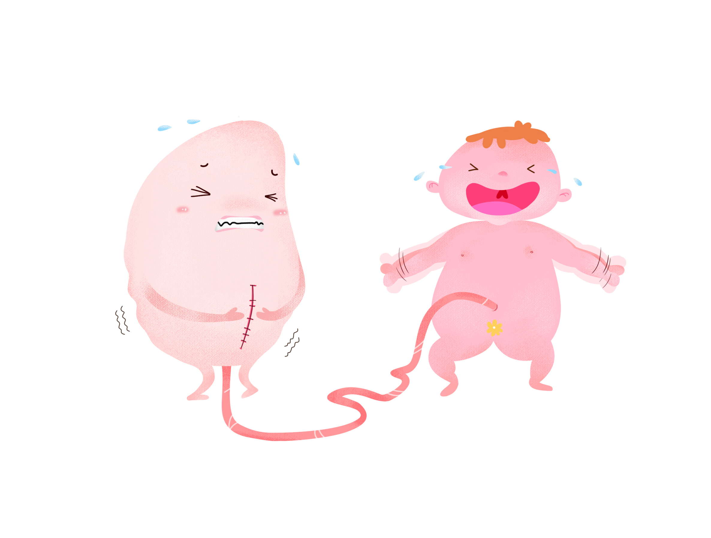 剖宫产科普漫画版,无痛分娩科普画