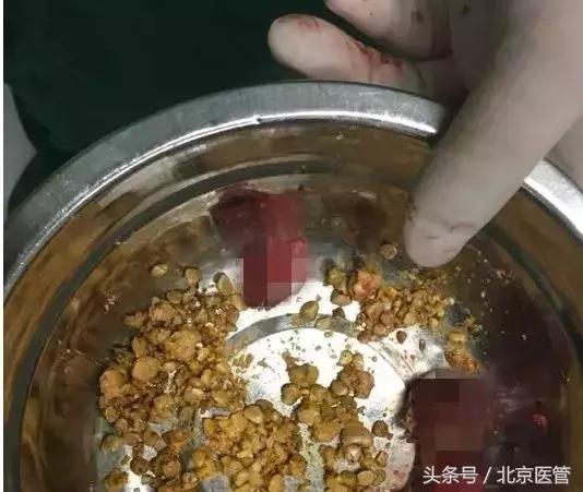 吃完螃蟹后的注意事项,吃完螃蟹之后要注意什么