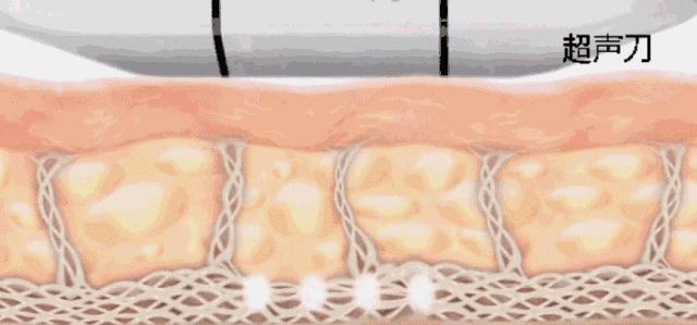 微商胶原蛋白是真的吗,微商胶原蛋白骗局揭秘