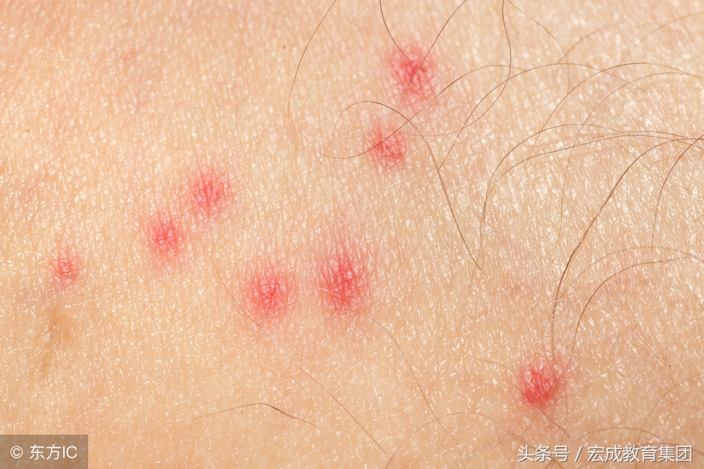 常见皮肤病用药及食疗方案,常见皮肤病诊断及用药图谱