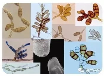 为什么脚气莫名其妙没有了,为什么脚气总是不能断根