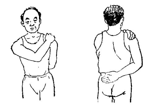 自我锻炼缓解肩周炎不适,自我治疗肩周炎