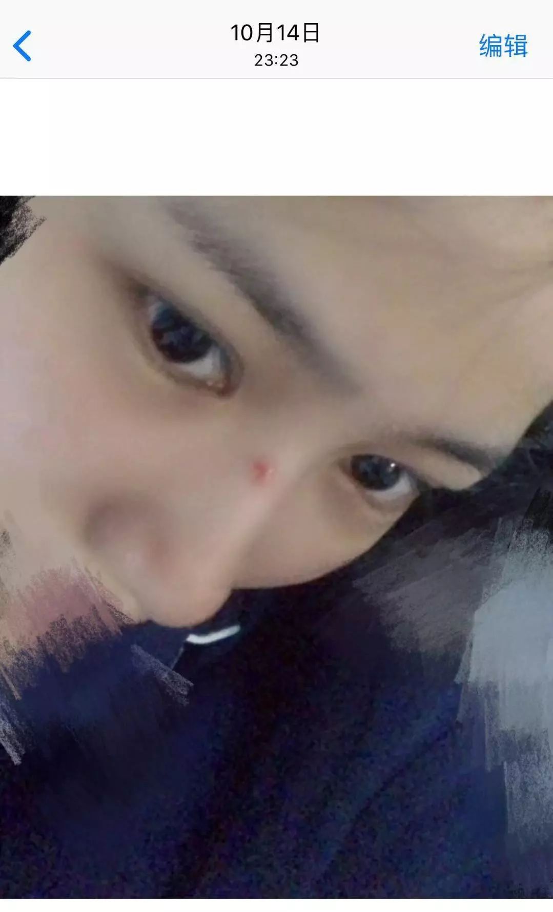 脸部被挠伤怎么不留疤,脸上被挠伤怎样才能不留疤