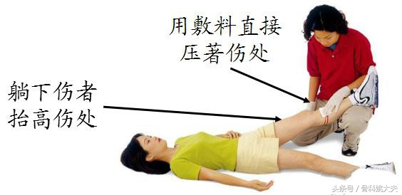 如何快速止血被刀划伤腿部,割伤流血的紧急止血方法