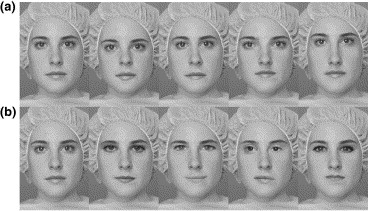 真正的脸盲症是什么,如何知道自己是否有脸盲症