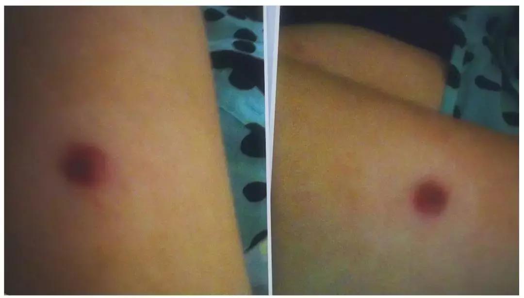 澳洲最新疫情澳洲入境最新通知,疫情下的澳洲真实情况