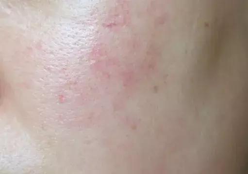 璧典附棰栧啹缁嶅嘲瀹樺绾㈣壊琛f湇,璧典附棰栧珌缁欑埍鎯呯殑鏍峰瓙