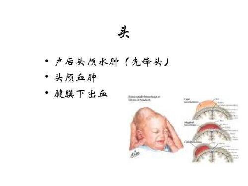 头上长瘤一般恶性的还是良性的,婴儿脑袋长个瘤会不会看出来