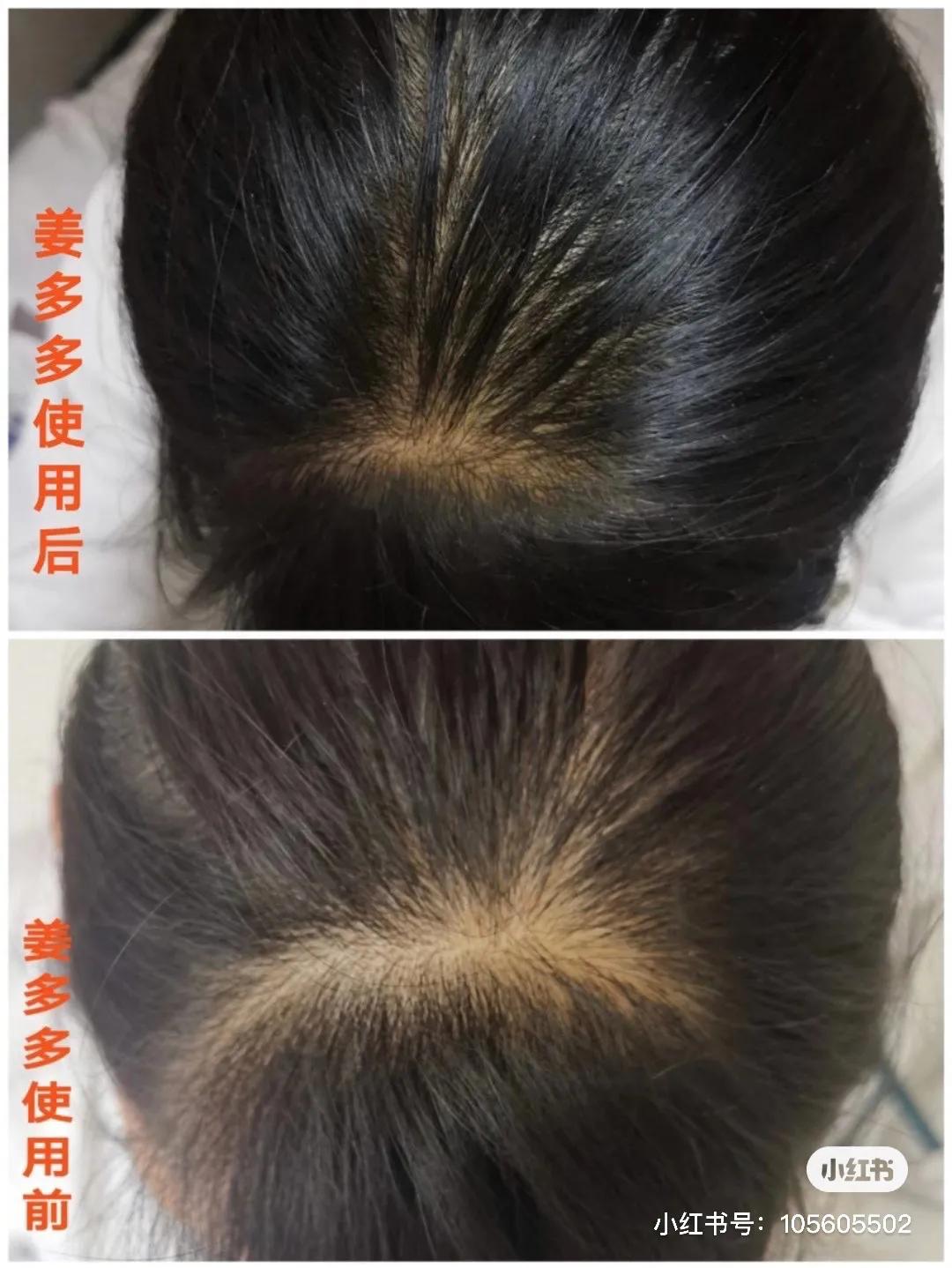 姜多多氨基酸洗发水,姜多多