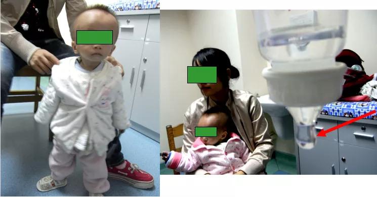 奶嘴用错了会影响吃奶量吗,奶嘴用错了