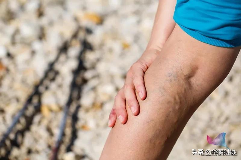 青筋暴起是怎么一回事,青筋暴起是怎么回事呢