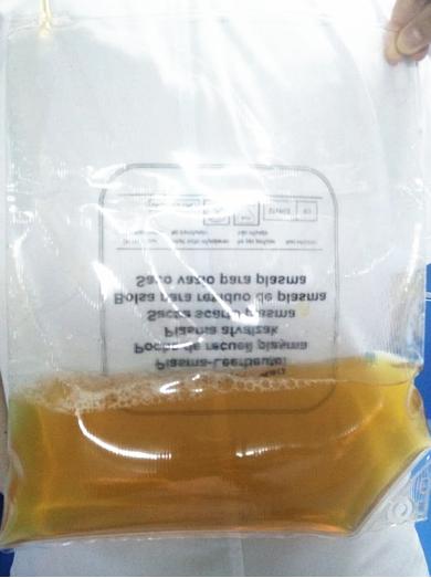 一代重生｜心梗难控制？干细胞疗法治疗心梗、心血管病不在话下