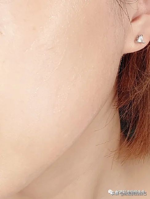 斑点暗黄肌最全的改善小技巧，都在这里