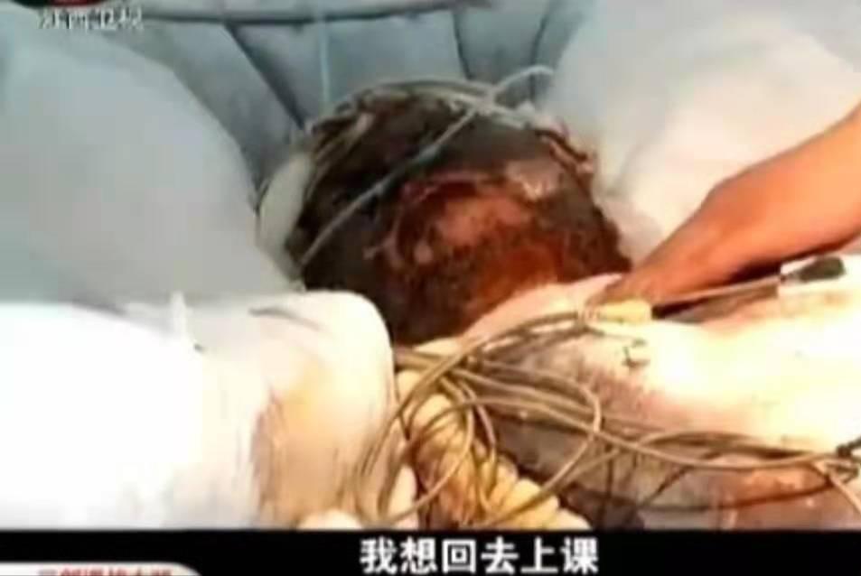 一对夫妻救下两名不慎落水的孩子,12年前翁婿大火救人