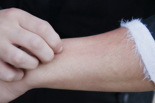 皮肤过度清洁有什么危害,过度清洁脸部有什么伤害