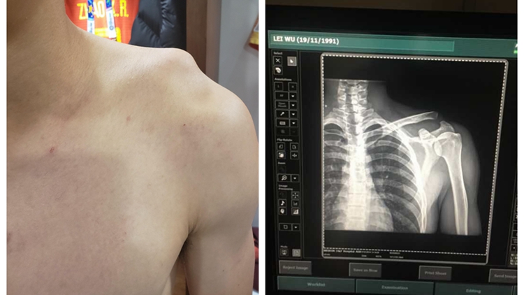 潘多拉魔盒打开就关不上,打开就关不上的各种柜门抽屉