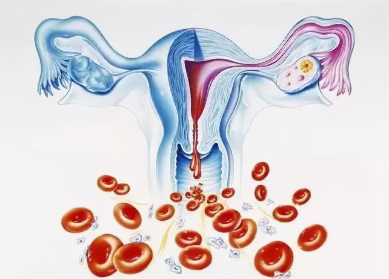 女性结扎后卵子排到哪里了,结扎后排出的卵子去哪了