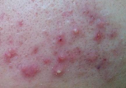 洗面奶被商家拉黑的测评,哪些洗面奶用了会起痘