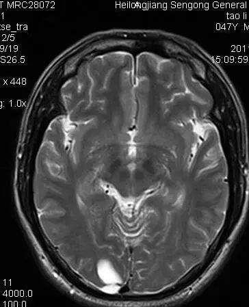 深度学习算法基础算法模型与实战,深度学习目标检测识别的训练思路