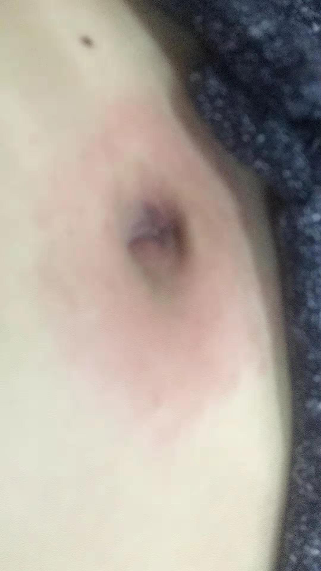 喝点茶就腰痛,喝生茶腰痛