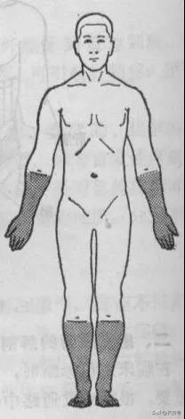 中风一侧手脚无力怎么恢复按摩图,医疗科普四肢无力是按摩惹的祸吗