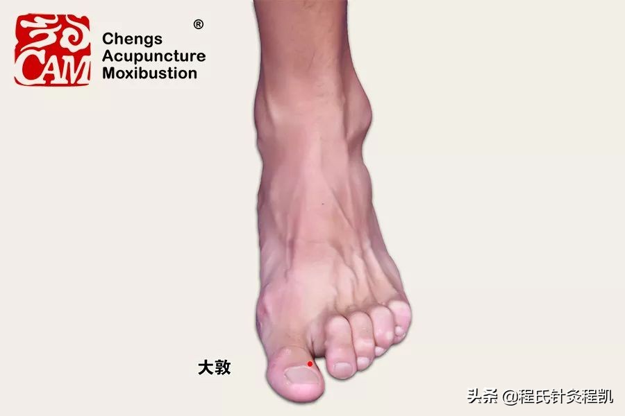 “大动肝火”导致头晕头痛、烦躁易怒,中医三招降肝火