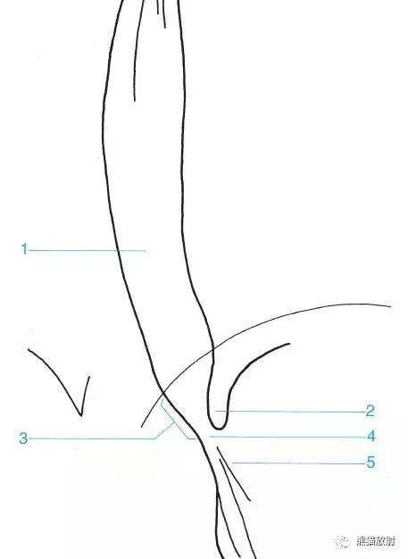 「收藏」11种消化道造影解剖图谱