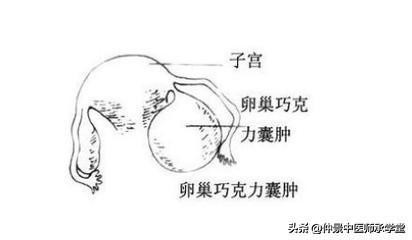 中医促排卵汤，辩证运用，多囊卵巢综合征也可以怀孕。