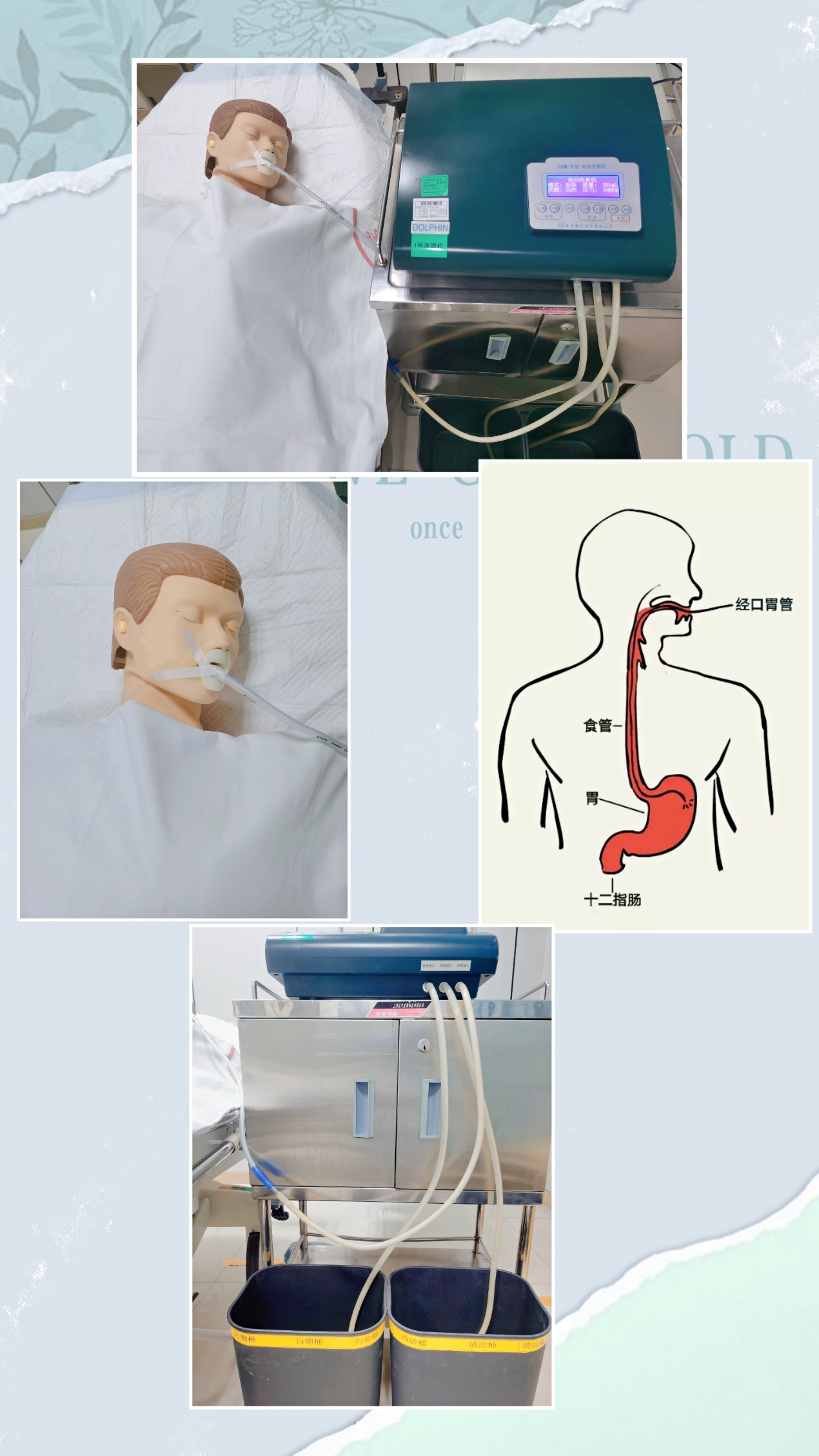 洗胃技巧,解毒秘法