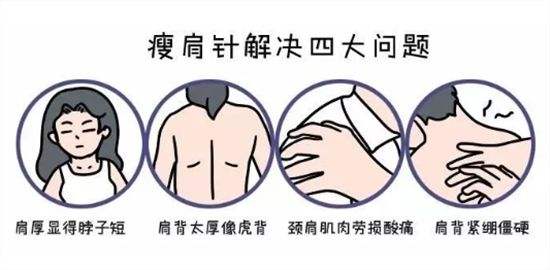 瘦肩针有用吗真实测评,中医认为瘦肩针有副作用吗