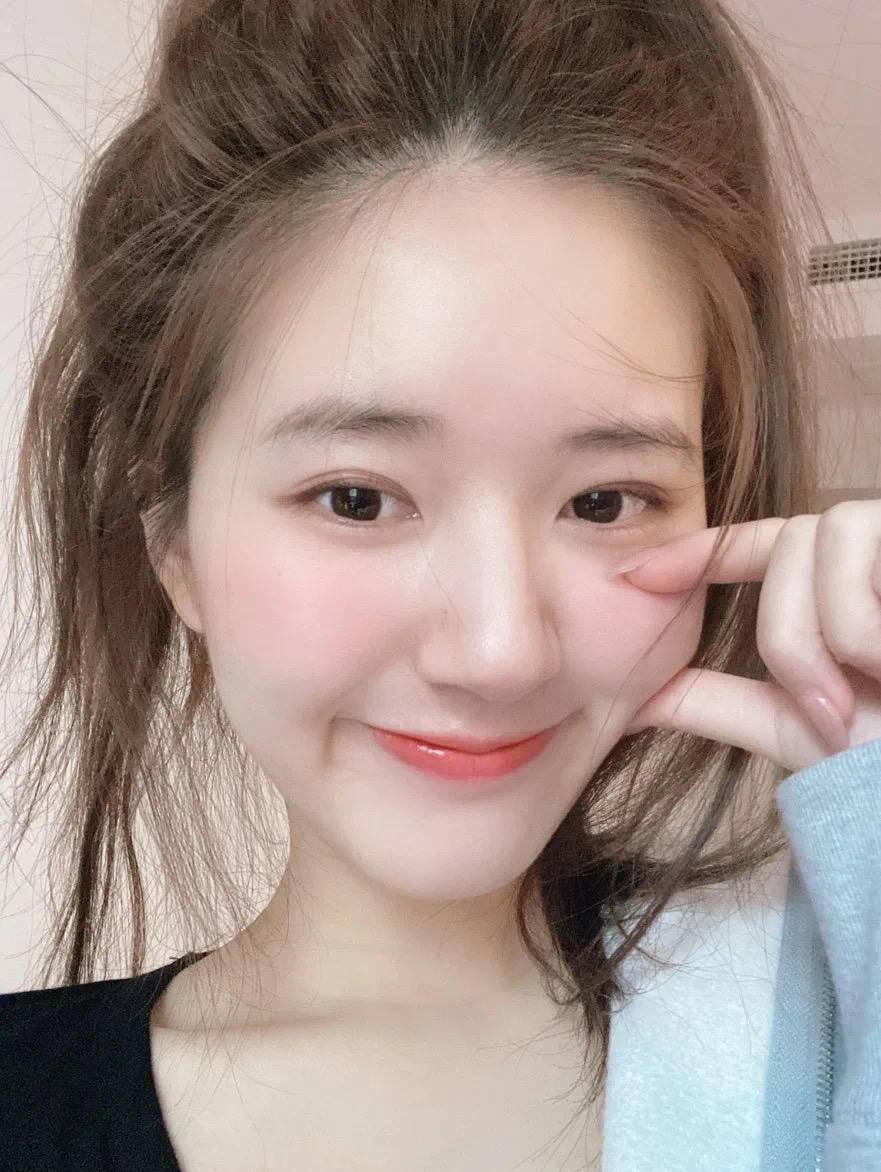 嘴唇水嘟嘟的太可爱了，但你的怎么还那么干瘪