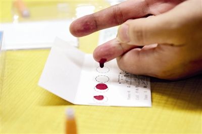 被狗咬了没出血有淤青怎么处理,被狗咬出血怎么处理