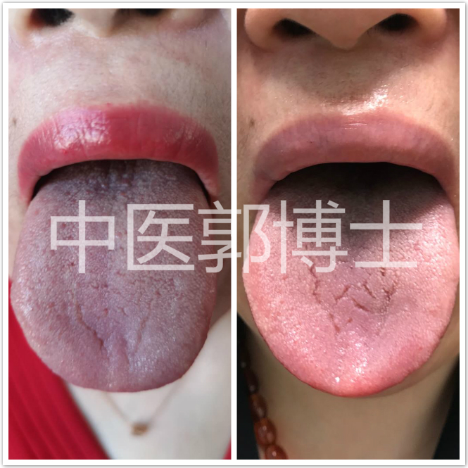 45岁闭经经方咋治,月经不调绝经用啥中药