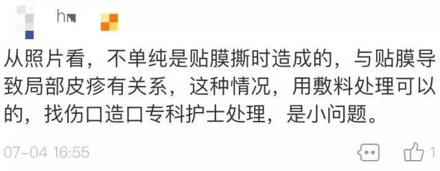 撕贴膜有气泡怎么办,贴膜有大水泡需要处理吗