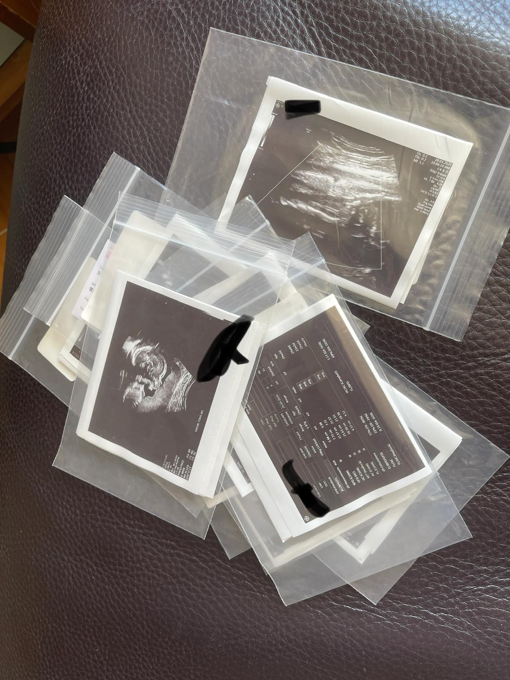 香港私家医院生娃 (香港宝妈医院生孩子)