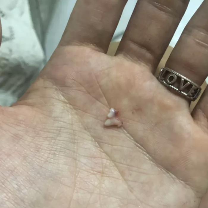 给狗拔牙视频金毛,金毛狗狗拔牙