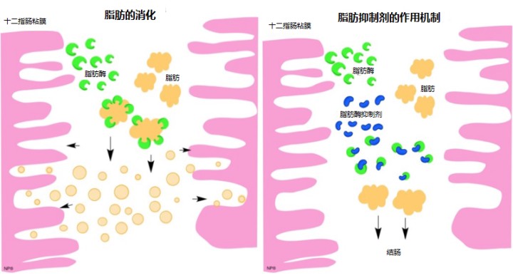 减肥药澳利司他真能减肥吗,奥利司他真的可以有效减肥吗
