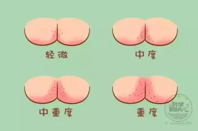 孩子全脸上身上长了疹子,小孩容易出现的各类疹子