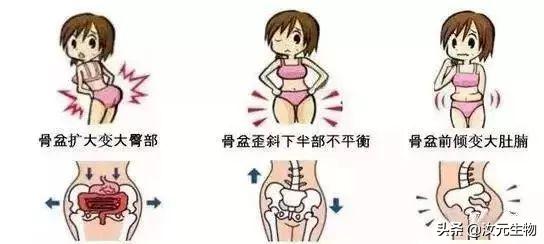 产后骨盆松弛有多可怕