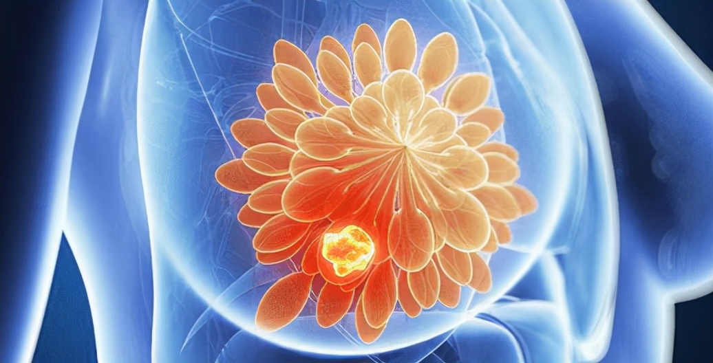 右乳低回声进一步检查什么,右乳低回声区内回声不均